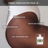 image:imageAdvanced Clinicals Hyaluronic Acid Moisturizer Body Cream  Hydrating Cream amp Body Lotion For Women amp Men To Help Improve Look of Wrinkles Stretch Marks Dry Skin amp Crepey Skin 16OZ  Travel SizeGreen Coffee Bean Oil ThermoFirming Cream