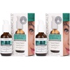 image:imageAdvanced Clinicals Retinol Serum For Face  Hyaluronic Acid Moisturizer  Vitamin C Serum 3PC Skincare Set For Women amp Men  Anti Aging Serums For Brightening Firming amp Hydrating  175 Fl Oz 3pcPuffy Eye Correcting Serum
